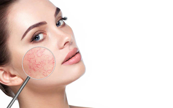 Sensitive Skin Routine: Dermatologist Tips for Redness and Irritation