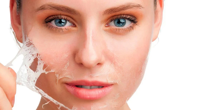 Chemical Peels: What to Expect, Benefits, and Aftercare