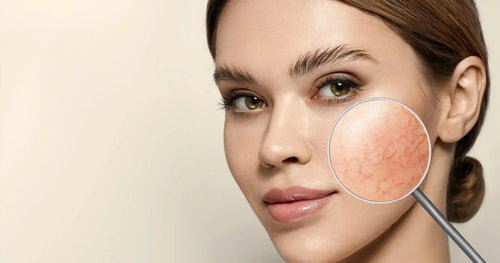 Sensitive Skin Routine: Dermatologist Tips for Redness and Irritation
