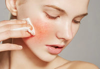 Skin Barrier Repair 101: How to Fix Redness, Dryness & Irritation Fast (Dermatologist Guide)
